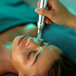 MICRONEEDLING ESTIMULACIÓN DE LA FIRMEZA Y LA ELASTICIDAD